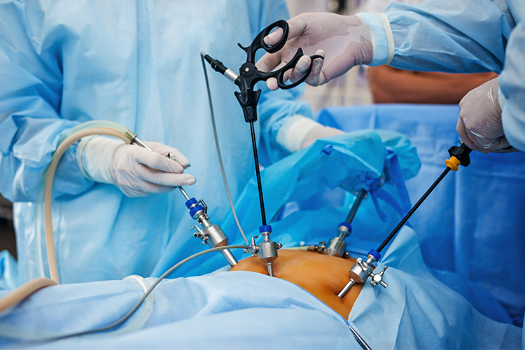 laparoscopic-surgery-in-pune